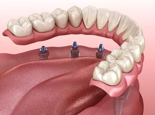 Sleep and Airway Solutions with Dr. Jeremy Montrose