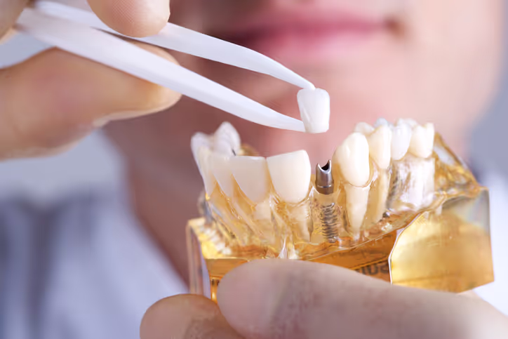 TMJ and TMD Treatment with Dr. Jeremy Montrose